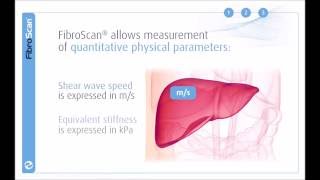 3 Stages of the FibroScan examination [upl. by Anaert]