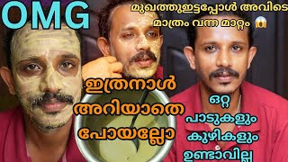 യൂട്യൂബിൽ തന്നെ ആദ്യമായി ഈ ട്രിക്ക് അറിയാതെ പോകരുത്ഒരാഴ്ച്ച മതി പാടുകൾOpen porestan മാറും [upl. by Ykcir128]