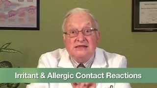 Irritant amp Allergic Contact Reactions [upl. by Myk618]