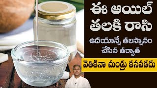 How to Reduce Dandruff Easily  Home Remedy to Scalp Reduce Itching  DrManthenas Health Tips [upl. by Haidabej]