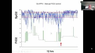 EPISODIOS DE HIPOXEMIA EN EL PREMATURO [upl. by Marguerie233]