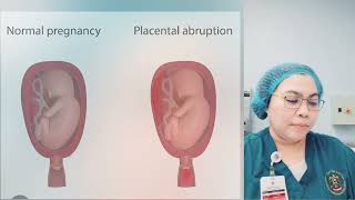 Antepartum and Intrapartum Hemorrhage Diagnosis and Clinical Management [upl. by Ardnosac]