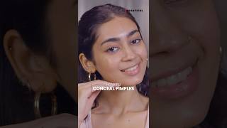 How to Conceal Your Pimples  Pimple Coverage Hacks  Flawless Skin Makeup  BeBeautiful shorts [upl. by Acinorahs435]