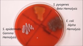 Microbiology Degradative and Motility Tests TimeLapse [upl. by Lupien]