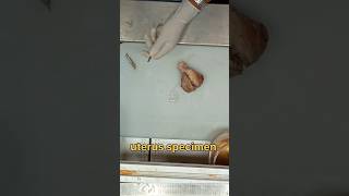 Uterus specimen cutting 🧐✂️ [upl. by Larena]