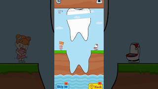 Slice this teeth🦷 to save trending viralvideo funny shorts [upl. by Otina549]