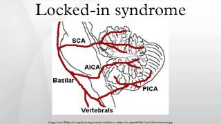 Communication with a person with the Lockedin Syndrome LIS [upl. by Annayt]