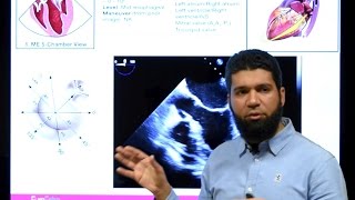 Basics of TransEsophageal Echocardiography [upl. by Jaela]