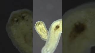 Planarian parasite flatworms under microscope [upl. by Hausmann406]