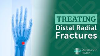 Treating Distal Radius Fractures at Dartmouth Health [upl. by Rehpatsirhc]