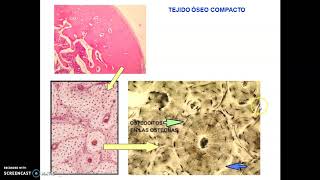 Clases Tejido Óseo parte II [upl. by Annmarie]