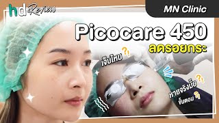 รีวิว เลเซอร์กระตื้น ด้วย Picocare 450 ลดรอยกระ รักษาฝ้าบนใบหน้า ที่ MN Clinic  HDreview [upl. by Letney91]