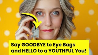 Say Goodbye to Eye Bags 5 Effective Solution [upl. by Schreiber]