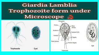 shorts  Giardia Lamblia Trophozoite form under Microscope 🔬 during Stool examination [upl. by Ahcsat]