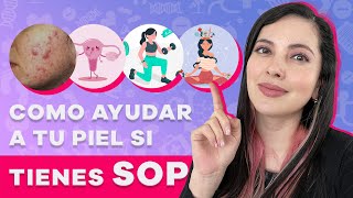 Síndrome de Ovario Poliquistico y PIEL Tips de una Dermatóloga [upl. by Blase]