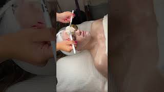 Dermaplaning facial breakdown 💫🩵 [upl. by Eladnor]