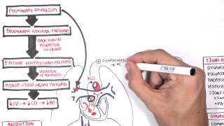 Pulmonary Embolism PART I Overview [upl. by Aracal]