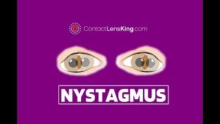 Nystagmus Eyes Explained  Involuntary Repetitive Eye Movement [upl. by Pigeon]