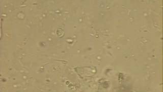 Giardia Trophozoite Looped [upl. by Ised446]