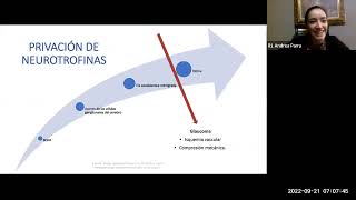 Mecanismo Apoptótico de las Células Ganglionares en Glaucoma 21 Septiembre 2022 [upl. by Thalassa]