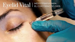 Eyelid Vital la mesoterapia indolora para el contorno de ojos [upl. by Dann314]