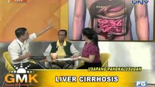 Usapang Pangkalusugan Liver Cirrhosis [upl. by Alduino]