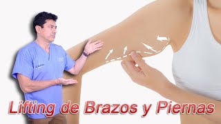 ¿Qué es el Lifting de Brazos y el Lifting de Piernas [upl. by Eidaj454]