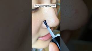 Get Rid Of Blackheads  Remove Blackheads Naturally At Home skincare beauty youtubeshorts diy [upl. by Etheline]