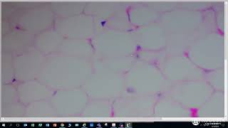 Anatomy amp Physiology 1 Loose Connective Tissue  Adipose Connective Tissue [upl. by Denton]