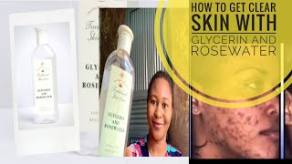 HOW TO USE GLYCERIN AND ROSEWATER FOR SKIN TONINGHOW TO GET CLEAR SKIN [upl. by Wenoa191]