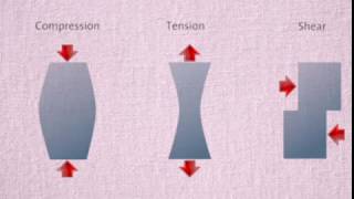 TV 2 Low Back Pain Biomechanics part 1 کمر درد، بیومکانیک کمر [upl. by Anaud549]