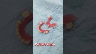 Partial Denture [upl. by Naitsirhc]