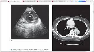 DIAGNOSTIC RADIOLOGY IMAGING [upl. by Goat]