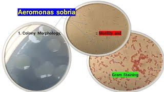 Aeromonas sobria Colony Morphology Motility and Gram Staining [upl. by Worl]