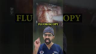 How is the Renal Embolization Procedure Performed kidneyhealth kidneyproblems [upl. by Imuya]