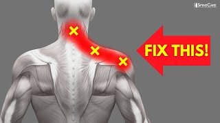 How to INSTANTLY Fix Pinched Nerve Pain in the Neck and Shoulders [upl. by Kevina]