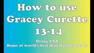 How to use Gracey Curette 1314 [upl. by Slen256]