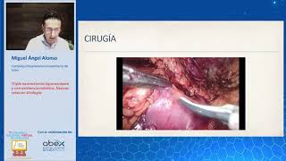 Triple Neurectomía con asistencia robótica Dolor inguinal crónico [upl. by Enajharas680]