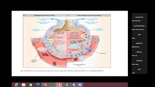 Edema Agudo Pulmonar [upl. by Ehtylb]