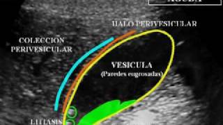 02 Ecografía Hepatobiliopancreática Fundamentos Básicos [upl. by Akerehs294]