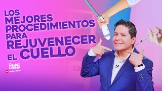 LOS MEJORES PROCEDIMIENTOS PARA REJUVENECER EL CUELLO  DR MARINO DERMATOLOGO [upl. by Tnahsarp]