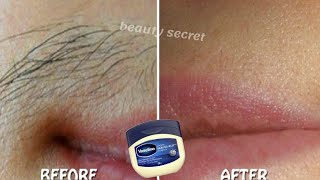 How to use Vaseline to permanently get rid of unwanted hair on the face and body [upl. by Oruntha]