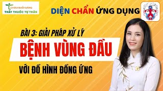 Bài 3 Hết ngay 70 quotĐAU ĐẦUquot Diện Chẩn ứng dụng cùng Hoàng Chinh Chào buổi sáng [upl. by Craig]