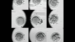 Evolución embriones FIV Embryoscope [upl. by Benetta]