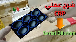 شرح عملي لفحص CRPPractical explanation of CRP examinationserial dilution [upl. by Katine311]