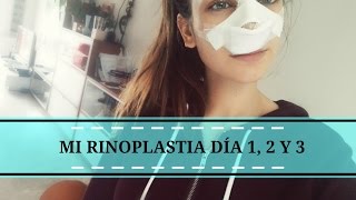 Mi rinoplastia  Día 1 2 y 3 [upl. by Doy969]