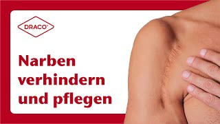 Narben verhindern amp Narben pflegen – der DRACO® Videoblog [upl. by Bliss]