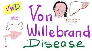 Von Willebrand Disease vWD  The Most COMPREHENSIVE Explanation  Hematology [upl. by Anor]