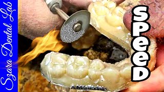 How to Finish Clear Retainers 3 tips Part 2 by Szara Dental [upl. by Brock]