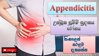 Appendicitis උන්ඩුක පුච්චි ප්‍රදාහය රෝග causes how it happens treatment sinhala how to prevent [upl. by Margarida]